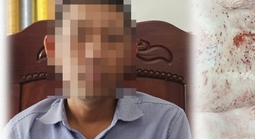 Vụ công an triệu tập người từng “tố” Công ty C.P. Việt Nam: Tình tiết pháp lý liên quan ông L.Q.N