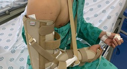 Chơi vật tay với bạn, nam sinh bị gãy xương