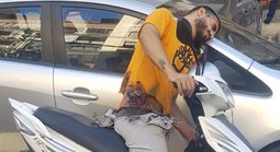 Đòn tấn công của Israel khiến hàng ngàn tay súng Hezbollah không thể hồi phục hoàn toàn