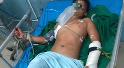 Vụ thảm án tại Đắk Lắk: Cháu trai 13 tuổi trèo tường, thoát chết kỳ diệu