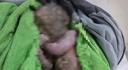 Cứu sống trẻ sơ sinh bị bỏ rơi đã ngừng tim, người đầy bùn đất