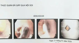 Bác sĩ cảnh báo một tai nạn nguy hiểm dễ gặp ở người già