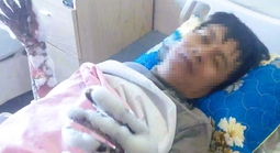 Thanh Hóa thông tin vụ nam công nhân bị điện phóng bỏng nặng 2 tay