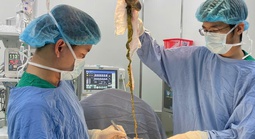 Bé trai phải lên bàn mổ vì ăn tóc, bác sĩ cảnh báo tình trạng y khoa hiếm gặp