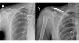Thêm 1 du khách người Nga được bác sĩ cấp cứu kịp thời