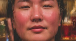 Đỏ mặt, nóng bừng sau uống rượu bia có đáng lo?