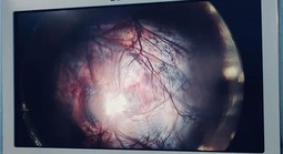 Giữ lại thiên chức làm mẹ cho bệnh nhân 22 tuổi