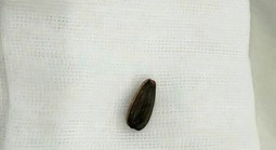 Bé 3 tuổi nguy kịch vì loại hạt thường có trên bàn tiếp khách dịp Tết