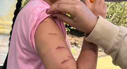 Nữ sinh lớp 5 ở Cà Mau bị người thân dùng dao cắt giấy gây thương tích