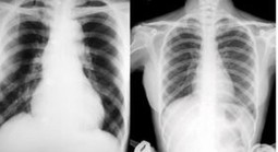 Vướng mắc thanh toán X-quang dưới 6 phút, BHXH Việt Nam lên tiếng