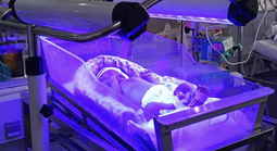 Cứu bé sơ sinh 30 giờ tuổi mang nhóm máu hiếm ở TPHCM