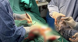 Người đàn ông nhập viện sau khi tự cắt bộ phận sinh dục