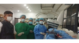 4 giờ cân não lấy dị vật trôi vào tim người đàn ông 35 tuổi