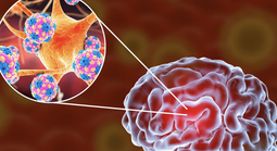 Bệnh nhi 11 tuổi bị viêm não mô cầu đã không qua khỏi