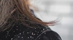 Chuyên gia cảnh báo: 50% dân số từng bị gàu nhưng điều trị chưa đúng