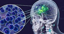 Thông tin liên quan ca dương tính viêm não mô cầu ở Cà Mau