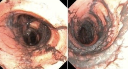 Ngạt khói nặng sau vụ cháy, đôi vợ chồng trẻ được hồi phục kỳ diệu