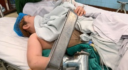 CLIP: Bác sĩ tháo rời máy xay thịt để cứu bàn tay người phụ nữ