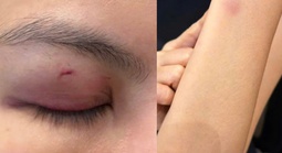 Luật sư nhận định vụ ca sĩ Trung Quân Idol bị tố đánh phụ nữ