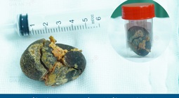 Đi khám sức khỏe định kỳ, người phụ nữ trẻ phát hiện điều bất ngờ