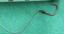 Người đàn ông ở Đà Nẵng nuốt phải lưỡi câu khi ăn cá
