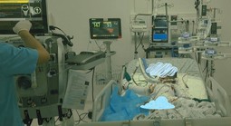Bé trai 4 tuổi nguy kịch sau vụ cháy, cần cộng đồng chung tay giúp đỡ