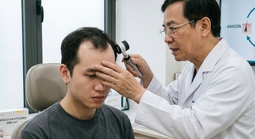 Người trẻ rụng tóc, hói đầu vì những thói quen tưởng vô hại