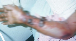 Vì sao WHO đánh giá nguy cơ Ebola vào Việt Nam ở mức thấp?