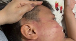 Thầy giáo Ấn Độ bị tố tát học sinh lớp 4 trong lớp học thêm ở Gia Lai