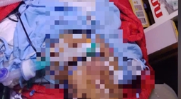 Bị bỏng nặng, mẹ đợi con thi xong tốt nghiệp THPT mới yên lòng nhắm mắt