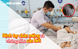 Làm sao để biết trẻ mắc bệnh tay chân miệng?