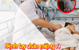 Làm sao để biết trẻ mắc bệnh tay chân miệng?