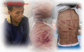Lời kể kinh hoàng của bé gái lớp 5 bị cha dượng đánh đến không đi được