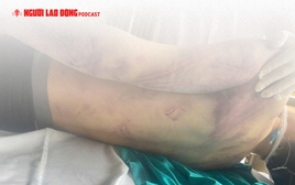 Kiểm tra toàn diện Trung tâm Công tác xã hội vụ học viên tử vong sau 2 ngày nhập học