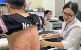 Khám miễn phí bệnh vảy nến