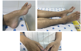 Mắc kèo nhà cái tỷ lệ cá cược lạ, nhiều năm mới phát hiện