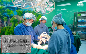 Bóc 18 khối u xơ, bảo toàn tử cung cho bệnh nhân