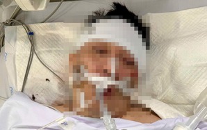 Tìm thân nhân người đàn ông bị tai nạn giao thông nặng đang cấp cứu trong bệnh viện