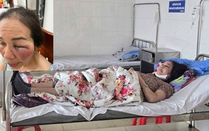 Làm rõ việc tiểu thương tố bị hành hung