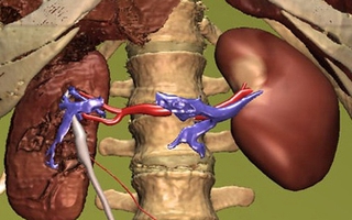 Đừng tưởng hư trái này còn trái khác!