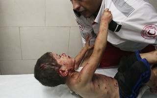 Nỗi đau của trẻ em ở Gaza