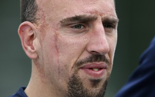 Chấn thương dai dẳng, Ribery vẫn được dự World Cup