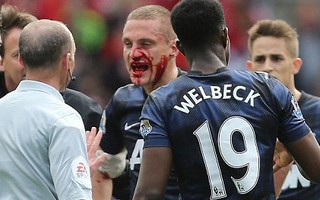 Vidic "lỗ mũi ăn trầu" ở trận đấu cuối cùng cho M.U