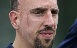 Ribery bất ngờ chia tay tuyển Pháp