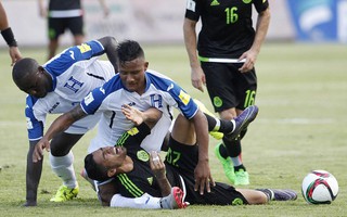 Rợn người cảnh cầu thủ Honduras gãy chân