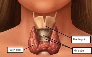 Tăng cân, rụng tóc, có phải bệnh tuyến giáp?