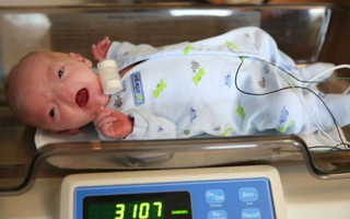 Thương tâm hai bé sơ sinh không mắt, không mũi