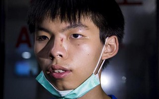 Hồng Kông: Joshua Wong và bạn gái bị đánh ngoài đường
