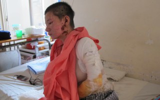 TP HCM: Đang đi, một nữ công nhân bị tạt axit