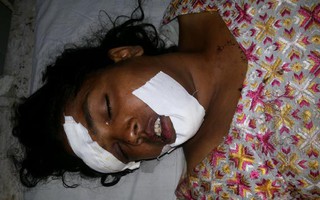 Ấn Độ: Bị quấy rối, con gái bỏ mạng, mẹ bất tỉnh